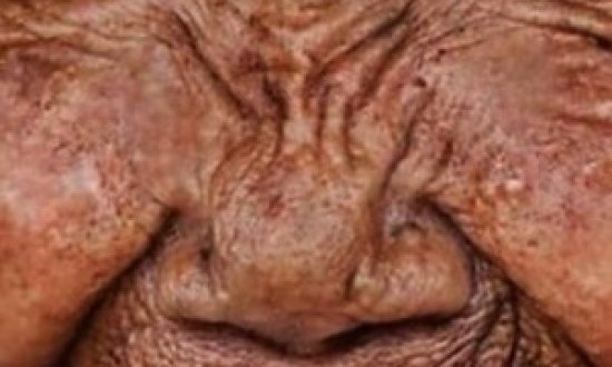 ΣΥΓΚΛΟΝΙΣΤΙΚΟ: Γυναίκα 100 ετών, γίνεται... 20 μέσα σε 3 λεπτά! (VIDEO)