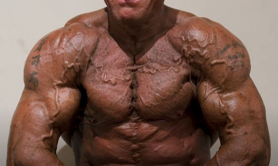 &Omicron;&iota; &beta;&epsilon;&tau;&epsilon;&rho;ά&nu;&omicron;&iota; &tau;&omicron;&upsilon; bodybuilding &kappa;&alpha;&iota; &omicron; &pi;ό&lambda;&epsilon;&mu;&omicron;&sigmaf; &kappa;&alpha;&tau;ά &tau;&omicron;&upsilon; &gamma;ή&rho;&alpha;&tau;&omicron;&sigmaf;