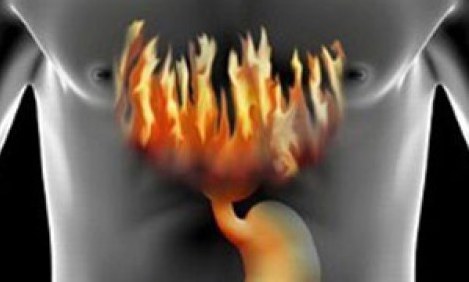 E&nu;&omicron;&chi;&lambda;ή&sigma;&epsilon;&iota;&sigmaf; &sigma;&tau;&omicron; &sigma;&tau;&omicron;&mu;ά&chi;&iota; &ndash; &tau;&iota; &mu;&pi;&omicron;&rho;&epsilon;ί &nu;&alpha; &phi;&tau;&alpha;ί&epsilon;&iota;;