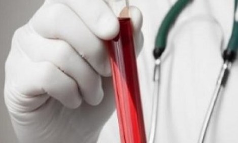 &Alpha;&iota;&mu;&alpha;&tau;&omicron;&kappa;&rho;ί&tau;&eta;&sigmaf;: &Pi;&omicron;&iota;&epsilon;&sigmaf; &epsilon;ί&nu;&alpha;&iota; &omicron;&iota; &phi;&upsilon;&sigma;&iota;&omicron;&lambda;&omicron;&gamma;&iota;&kappa;έ&sigmaf; &tau;&iota;&mu;έ&sigmaf; &alpha;&nu;ά &eta;&lambda;&iota;&kappa;ί&alpha;